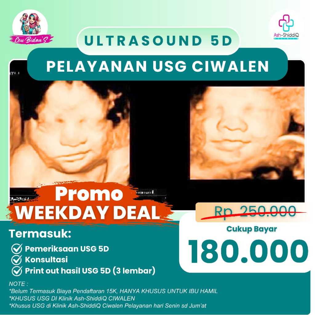 USG 5D PROMO WEEKDAY - Print Out hasil USG 5D (3 Lembar), Konsultasi, Pemeriksaan USG 5D