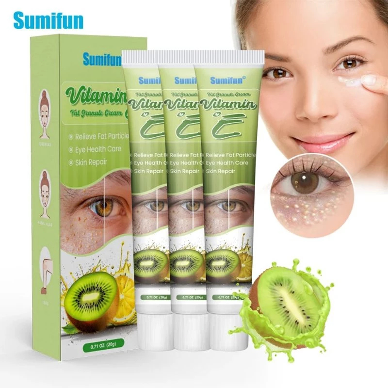 vitamin penghilang milia syringoma xanthelasma butiran lemak sekitar mata