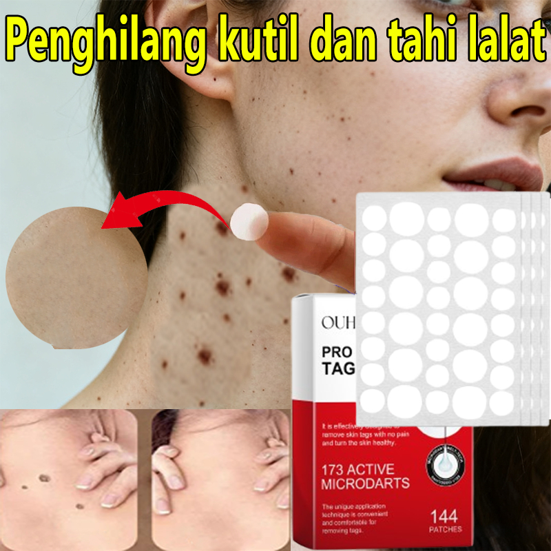 Stiker Penghilang Kutil Dan Tahi Lalat Wart Remover Patch Penghilang Kutil Di Leher Penghilang Tahi 