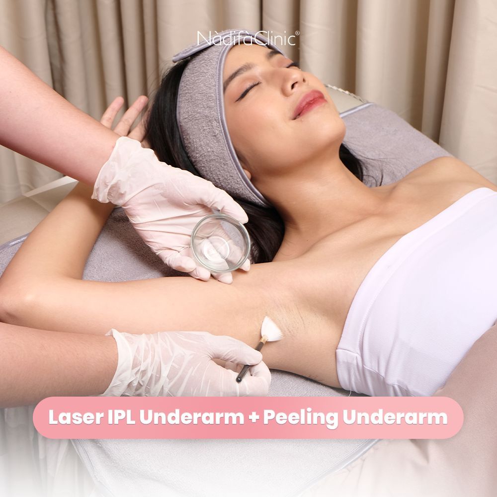 TREATMENT LASER IPL UNDERARM + PEELING UNDERARM