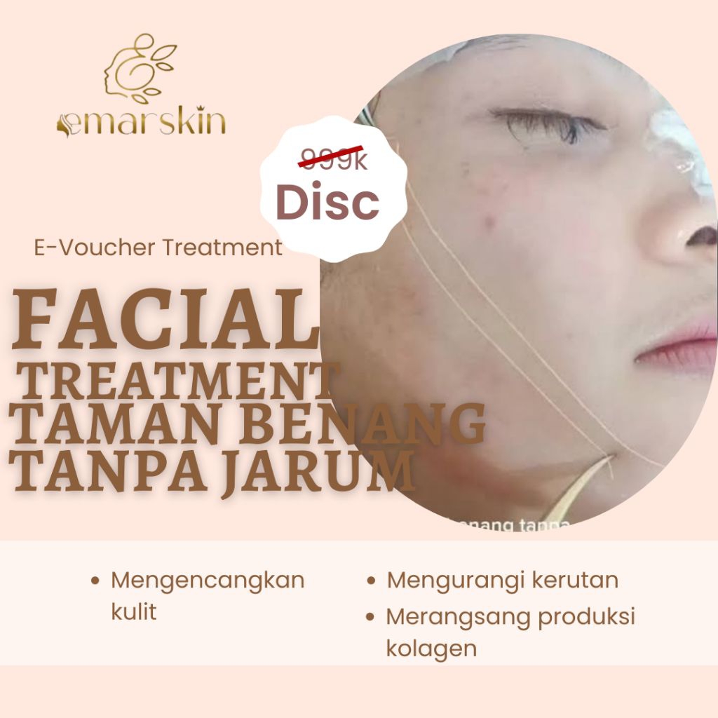 Voucher Facial Treatment Tanam Benang Tanpa Jarum
