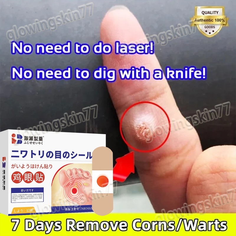 Plester Penghilang Kapalan & Mata Ikan - Koyo Kaki Jepang Asli 12pcs, Corn Patches Anti Kutil, Untuk