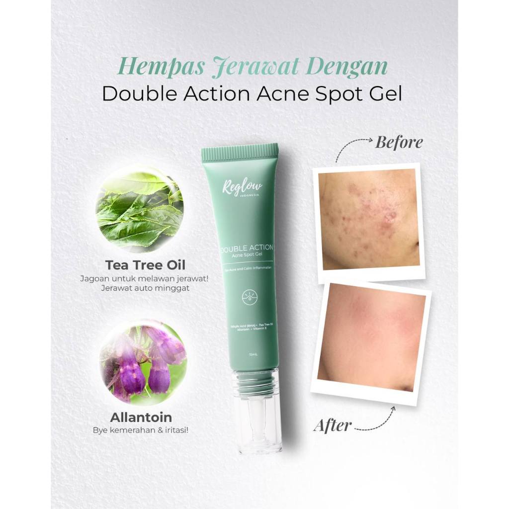 Reglow Double Action Acne Spot Gel Penghilang Jerawat dan Beruntusan Ampuh Obat Jerawat Batu Totol M