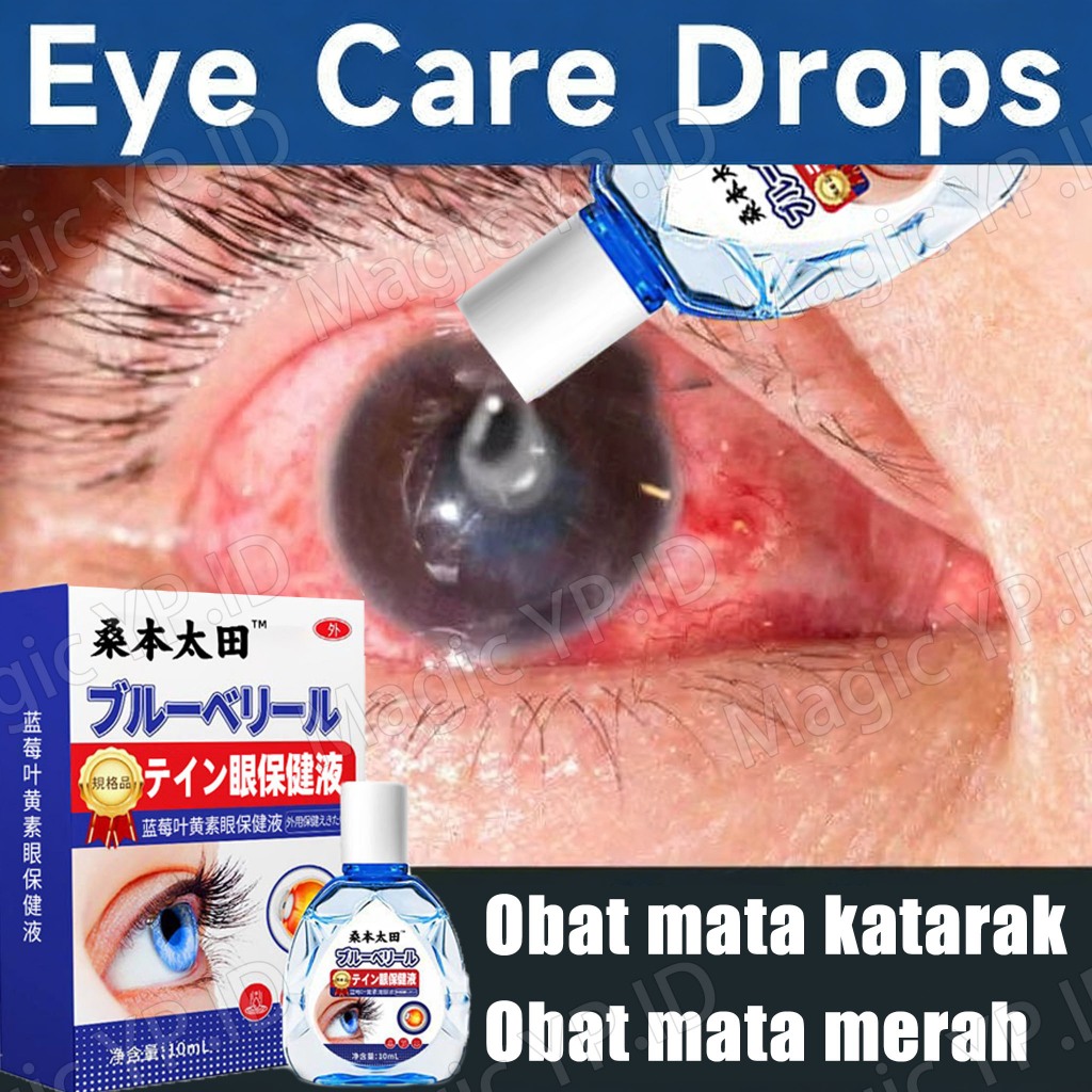 tetes mata obat mata katarak obat mata buram obat mata merah obat mata minus obat mata kuning obat m