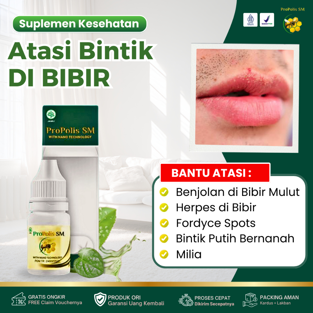 Obat Herbal Penghilang Bintik Putih Di Bibir, Luka Di Sudut Bibir, Bintik Bintik Gatal Di Bibir, For