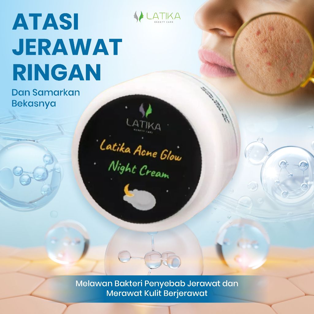 LATIKA CREAM MALAM ACNE GLOW EXPERT (cream putih) MAMPU MEMBANTU MEREDAKAN JERAWAT MERADANG DAN MENY
