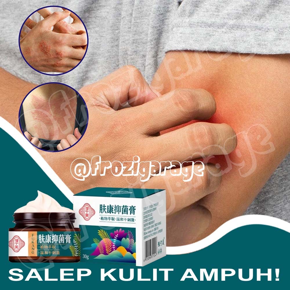KRIM GATAL SALEP GATAL PSORIASIS SALEP KULIT JAMUR SALEP EKSIM