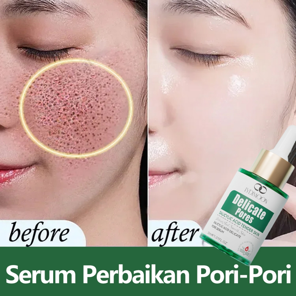 Esensi Pengencang Pori Menghilangkan bekas jerawat 30ml Serum Salicylic Serum penghilang komedo dan 