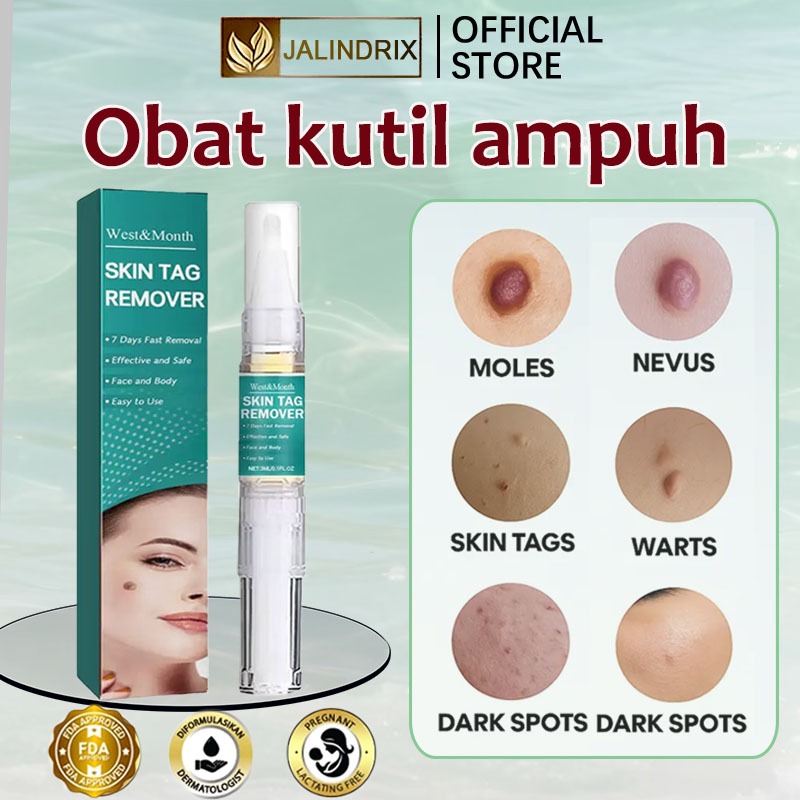Penghilang kutil dan tahi lalat salep kutil paling ampuh skin tag remover obat kutil ampuh ori kutil
