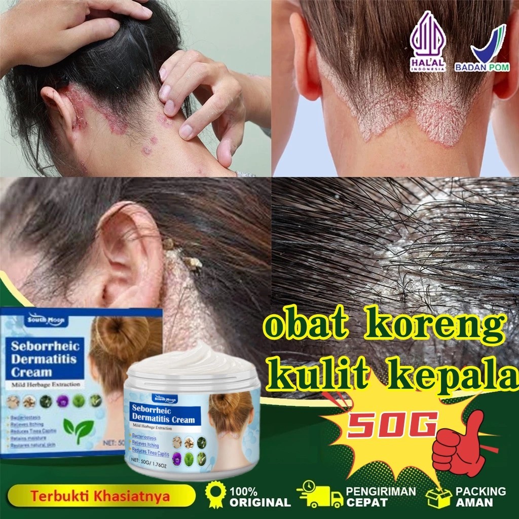 Kulit Kepala Gatal?Krim Kulit Kepala 50g – Redakan Gatal Kulit Kepala dengan Cepat