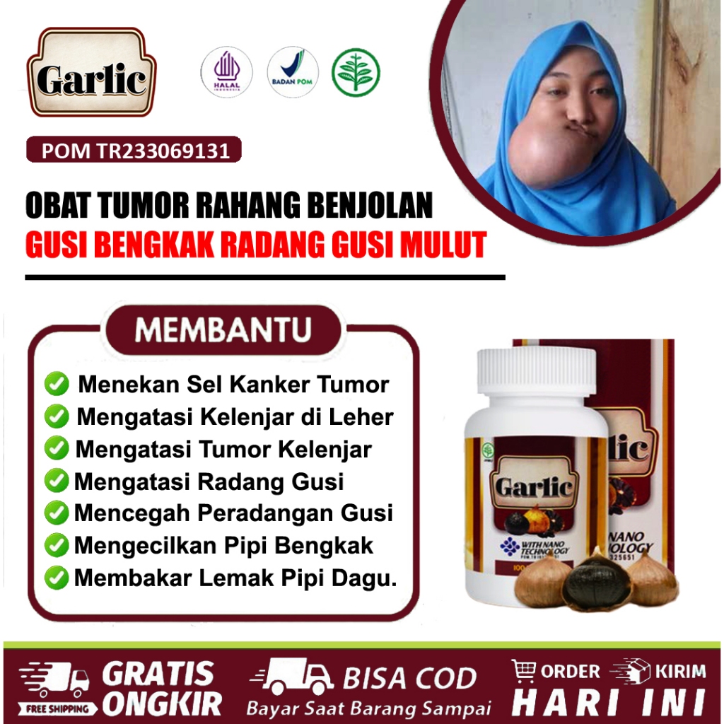 Obat Tumor Rahang Benjolan Gusi Bengkak Radang Gusi di Dalam Mulut Penghilang Lemak Di Dagu dan Pipi