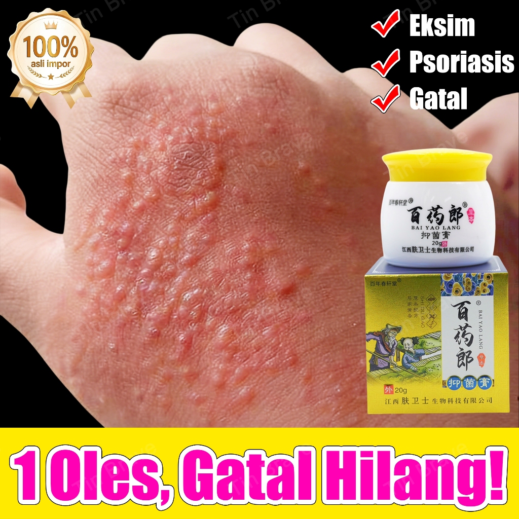 salep gatal anti jamur salep gatal eksim paling ampuh salep gatal selangkangan psoriasis cream obat 