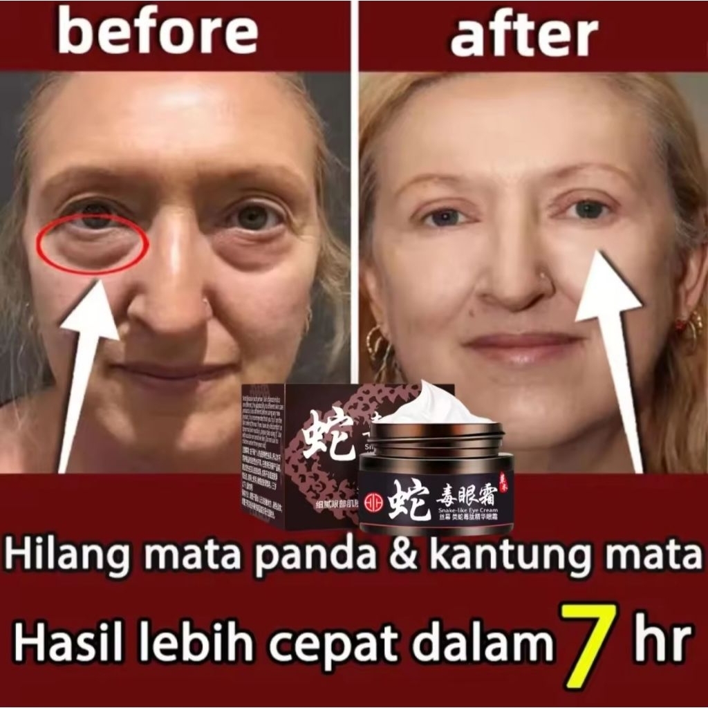 CREAM PENGHILANG KANTUNG MATA / CREAM PENGHILANG MATA PANDA / CREAM MILEA