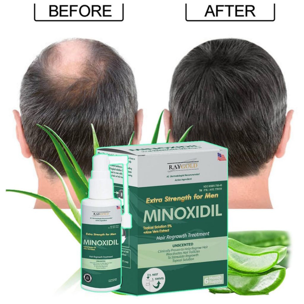 1 Box Ray Gold Minoxidil 5% Penumbuh Rambut Botak Paling Ampuh Dan Cepat Pria Original