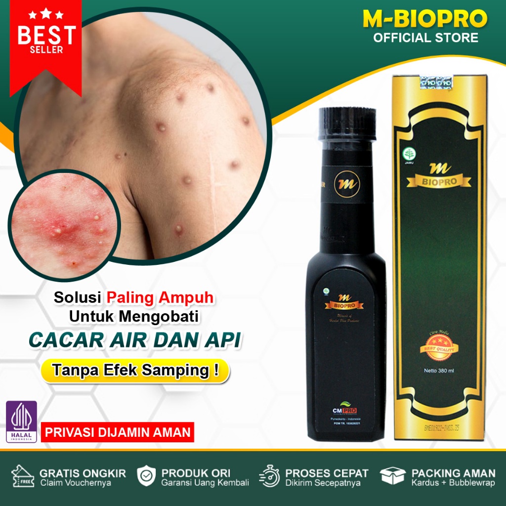 MBIOPRO Obat Herbal Cacar Air, Cacar Api, Cacar Monyet, Campak, Cacar Gatal, Penghilang Bekas Cacar,