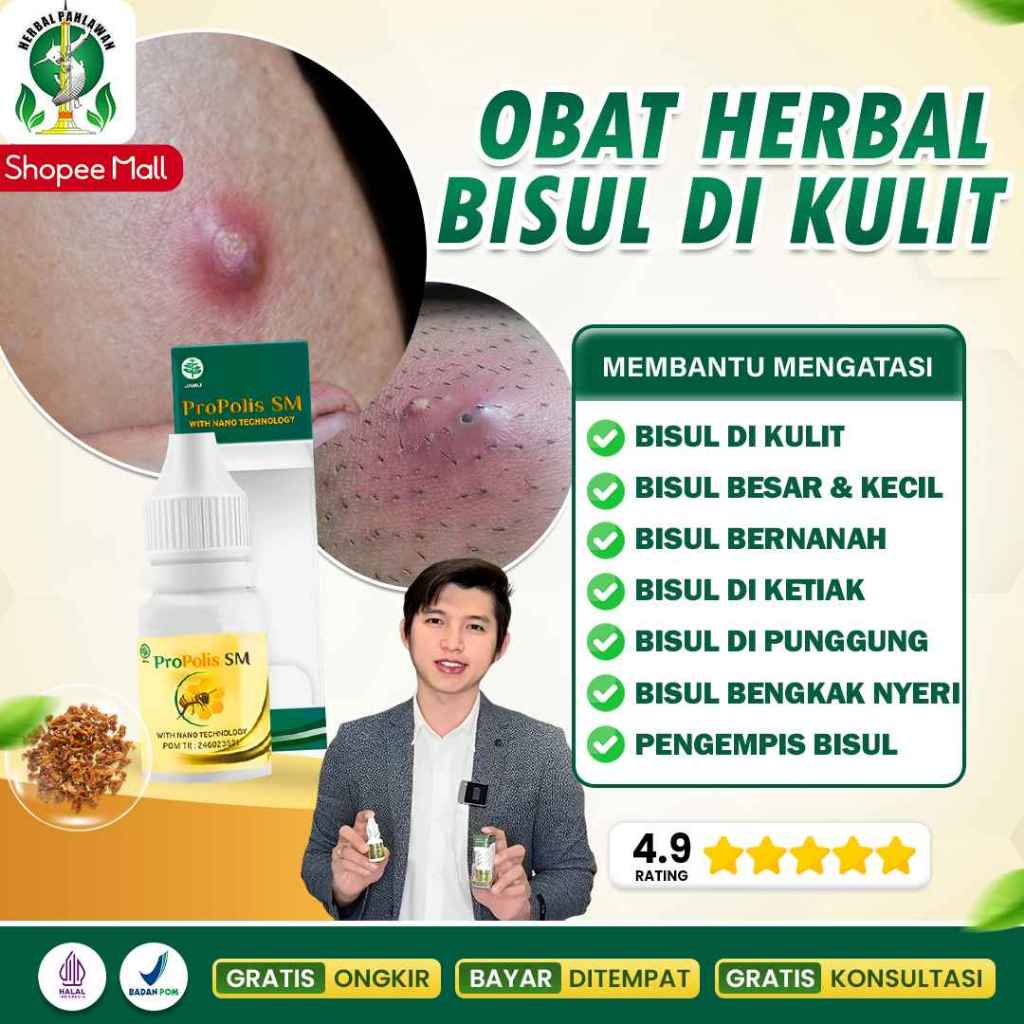 Obat Herbal Bisul, Obat Bisul di Kemaluan, Obat Benjolan Akibat Bisul, Obat Oles Untuk Pengempis Ben