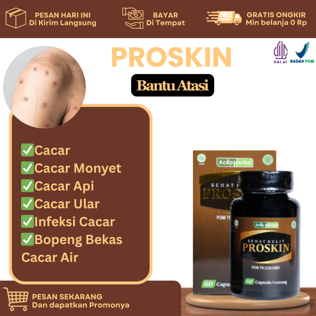 Obat Untuk Cacar, Cacar Air, Cacar Api, Cacar Bisul, Gatal Cacar, Cacar Bernanah, Ruam Kemerahan Di 
