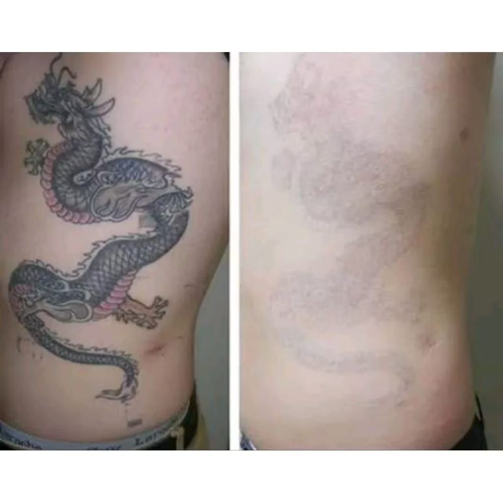 Obat Penghilang Penghapus Tatto Permanen Dan Sulam Alis Pk Oil cepat aman