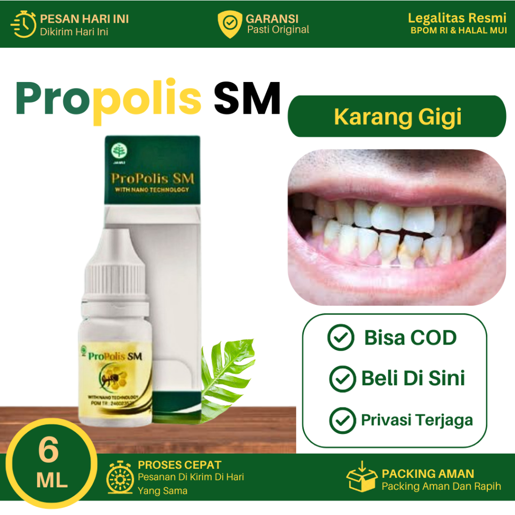 Obat Karang Gigi, Pembersih Karang Gigi Kuning, Perontok Karang Gigi, Membersihkan Karang Gigi Menah
