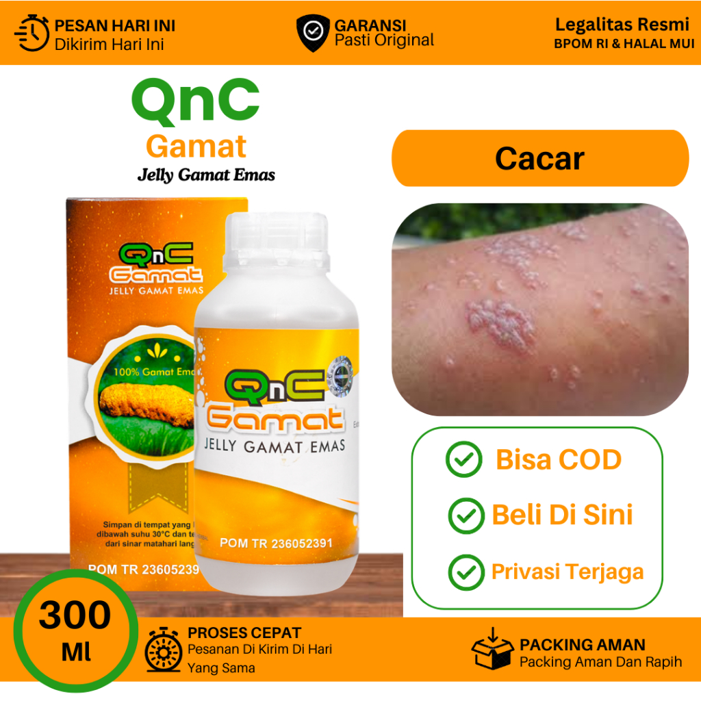 Obat Untuk Cacar, Cacar Bernanah, Api, Monyet, Cacar Gatal Bintik, Cacar Menonjol, Cacar Menghitam, 