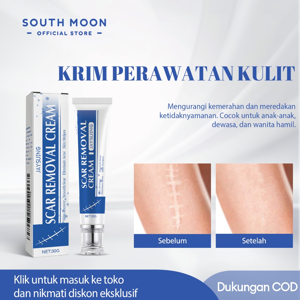 Jaysuing Salep Penghilang Bekas Luka 30g Krim Bekas LukaPemutihan Penghilang Menghaluskan Operasi Be