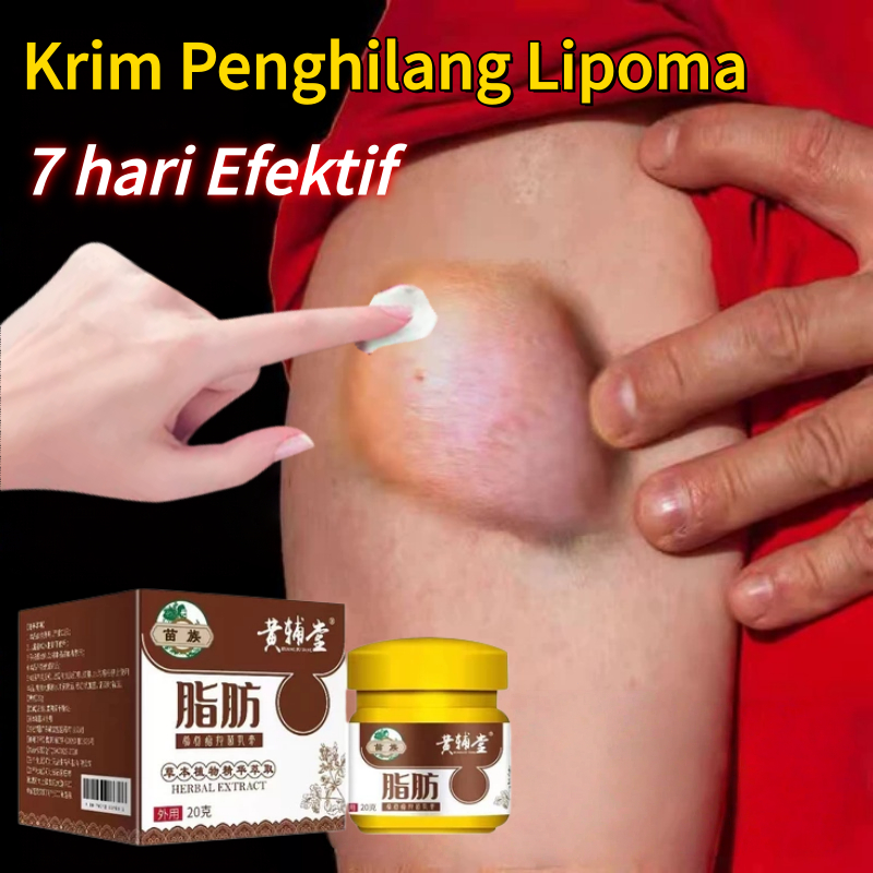 Obat benjolan Lipoma cream salep benjolan Lipoma removal cream original Penghilang lemak removal ben