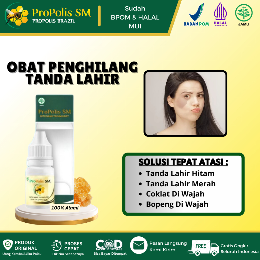 Propolis SM Untuk Penghilang Tanda Lahir, Tanda Lahir Hitam Merah, Coklat Di Wajah, Salep Meudarkan 