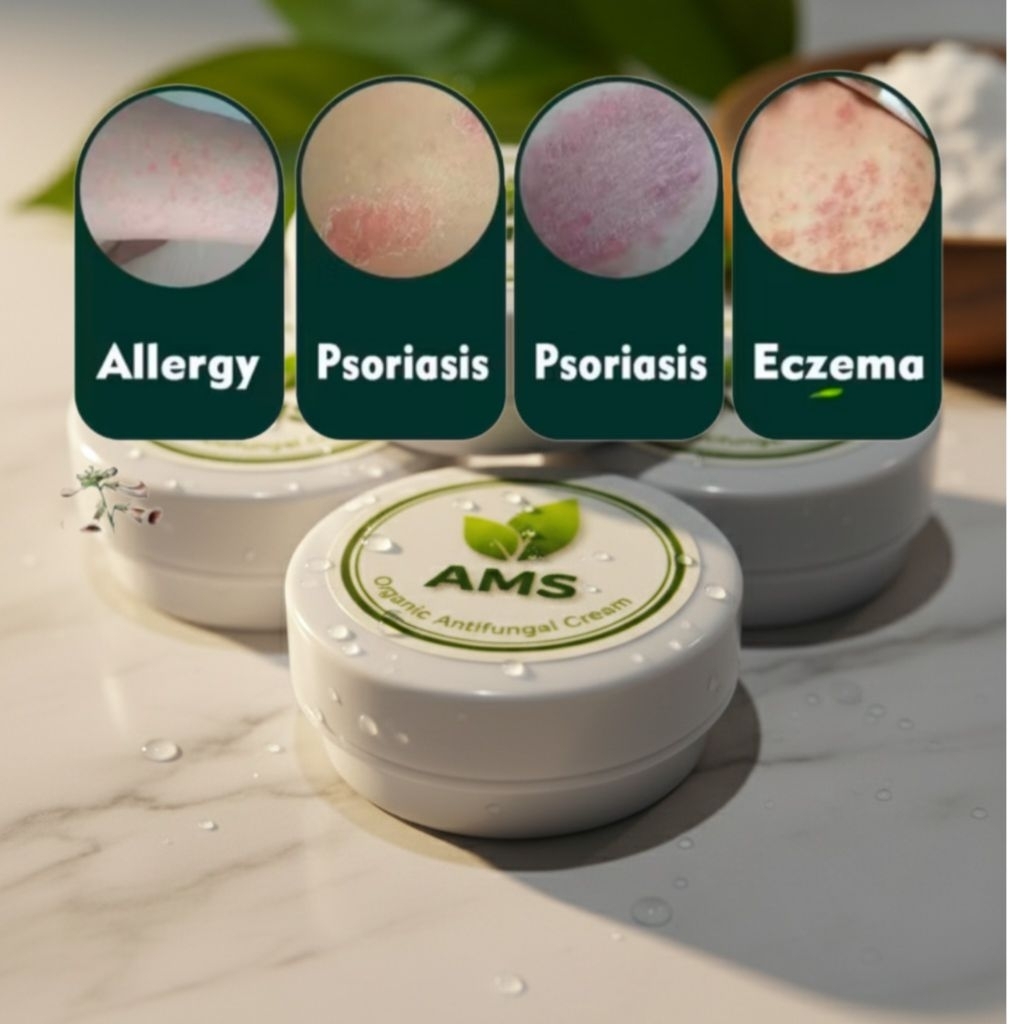 Ampuh Obat Ruam Popok Pada Bayi Kualitas Super AMS Cream