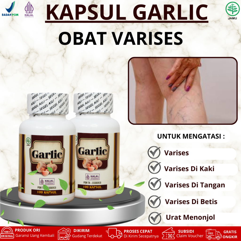 Kapsul Garlic Untuk Varises, Varises Di Tangan, Varises Di Kaki, Varises Di Betis, Urat Menonjol, Ur