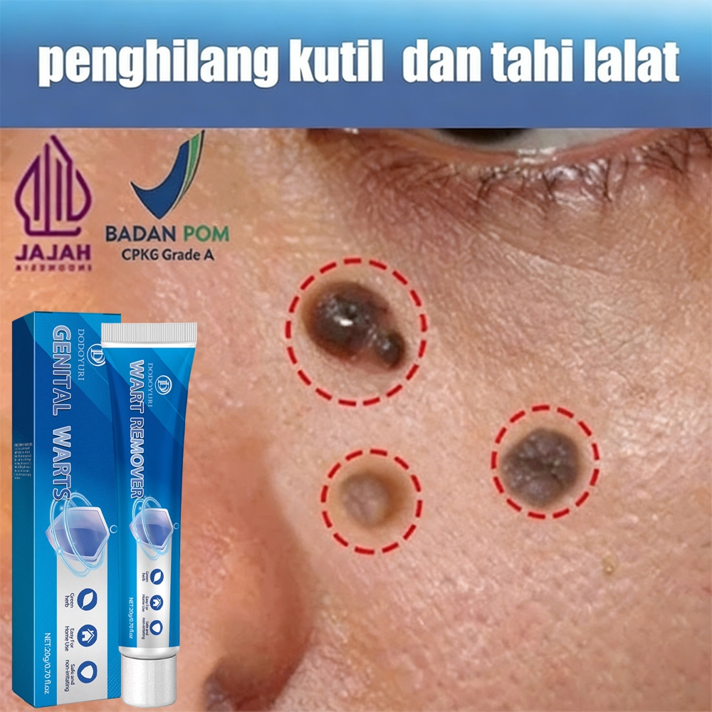 Penghilang kutil dan tahi lalat penghilang tahi lalat obat penghilang kutil 20ml penghilang kutil da