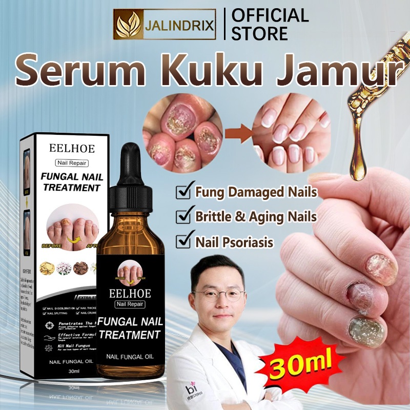 Jalindrix Obat jamur kuku serum kuku vitamin serum kuku jamur dan rusak obt kuku jamur dan rusak ori
