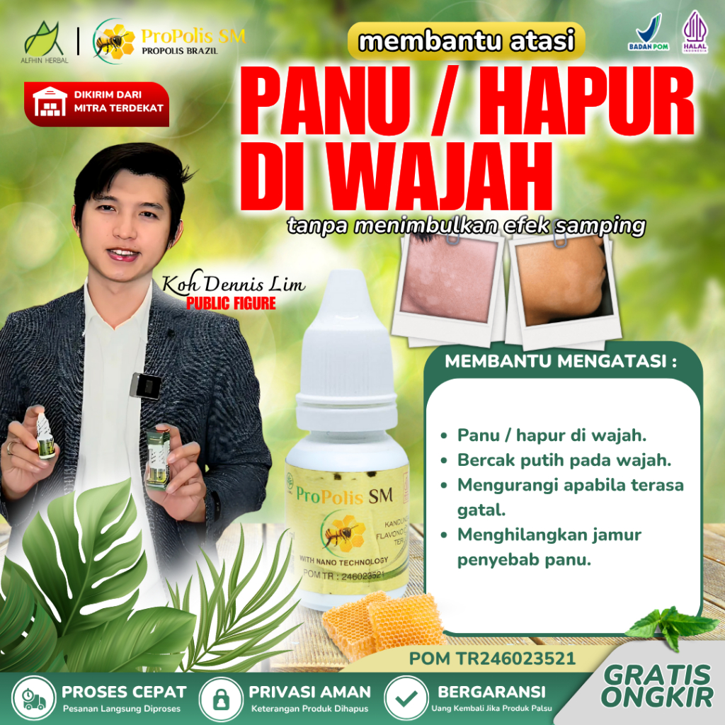 Obat Panu di Wajah, Penghilang Jamur Panu Hapur, Gatal Kudis Kering, Psoriasis Jamur Kulit, Hapur Pa
