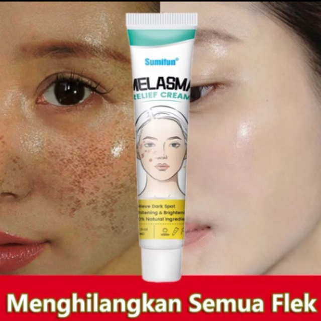 Cream Penghilang Flek hitam BPOM bintik Melasma Whaitening Cream