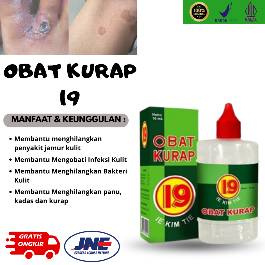 Obat Kurap 19 Cair Ampuh Untuk Panu, Kadas, Kurap, dan Gatal Jamur di Kulit