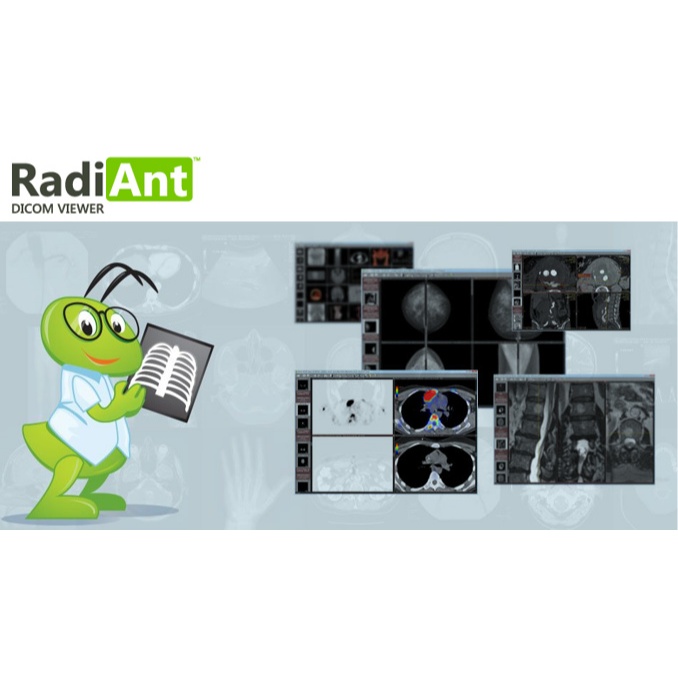Software RadiAnt DICOM Viewer 2025 full