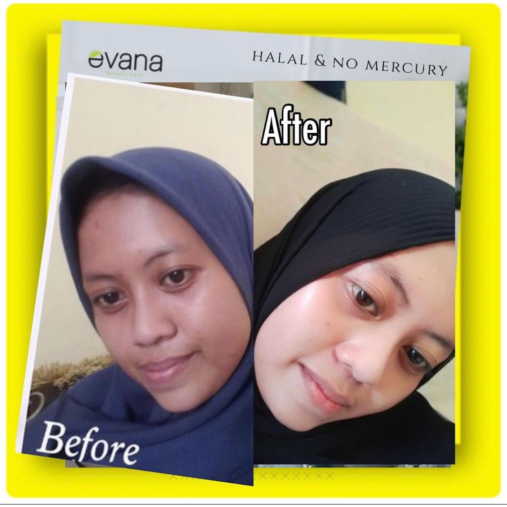 EVANA BEAUTY CARE  PAKET WHITENING