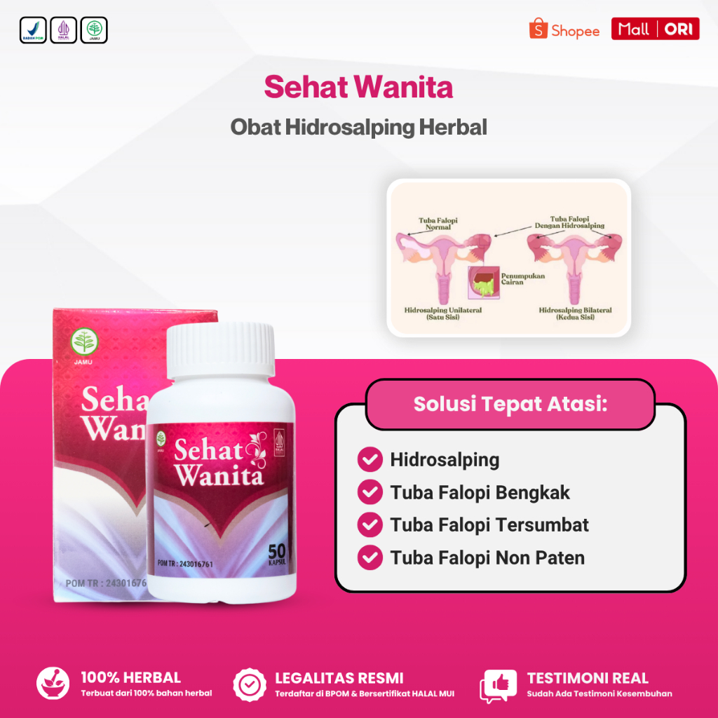 Obat Hidrosalping, Tuba Falopi Tersumbat, Tuba Falopi Bengkak, Tuba Falopi Non Paten, Sehat Wanita