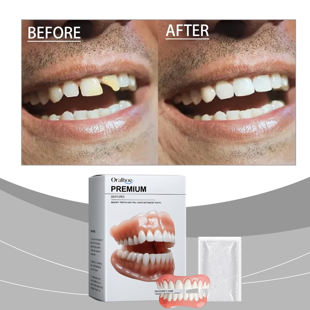 Oralhoe Gigi Palsu Lepas Pasang 1set Gigi Palsu Senyum Sempurna Gigi Veneer Gigi Palsu Instan Langsu