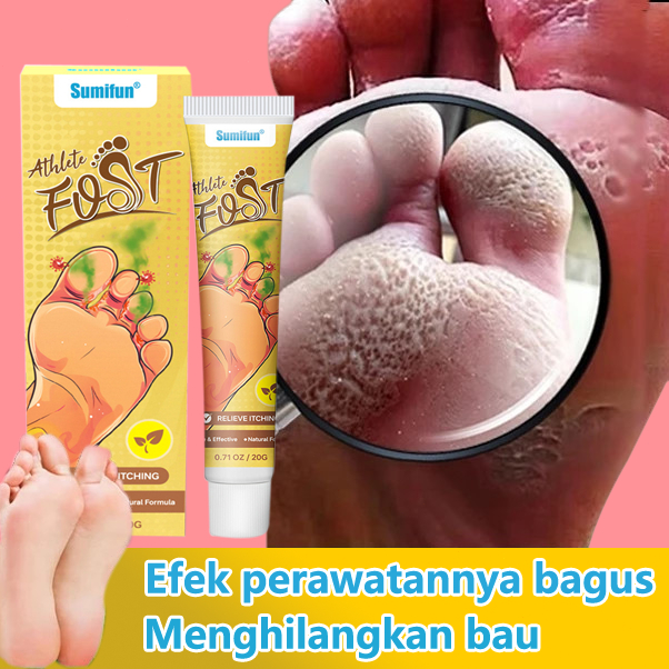 krim perawatan anti bakteri , menghilangkan jamur tinea pedis , salep perawatan kaki, krim perawatan