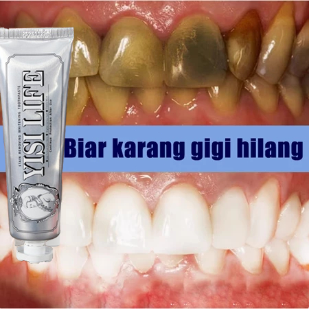 YISILIFE marvis Whitening mint toothpaste 100ml odol gigi marvis pasta gigi odol pemutih gigi karang