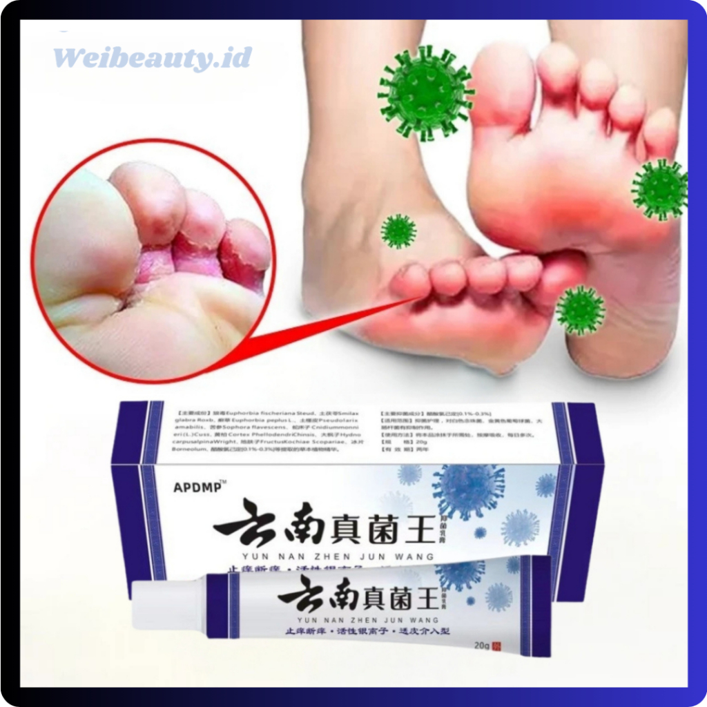 Obat Kaki Rayapan Telapak Kaki Bolong-Bolong dan Bau Kutu Air Rorombeheun Kaki Pecah-Pecah BB052