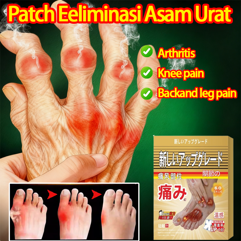 Obat Asam Urat Koyo Asam Urat Koyo Kaki Pereda Nyeri Sendi Obat Kaki Bengkak Obat Sakit Tumit Obt Ny