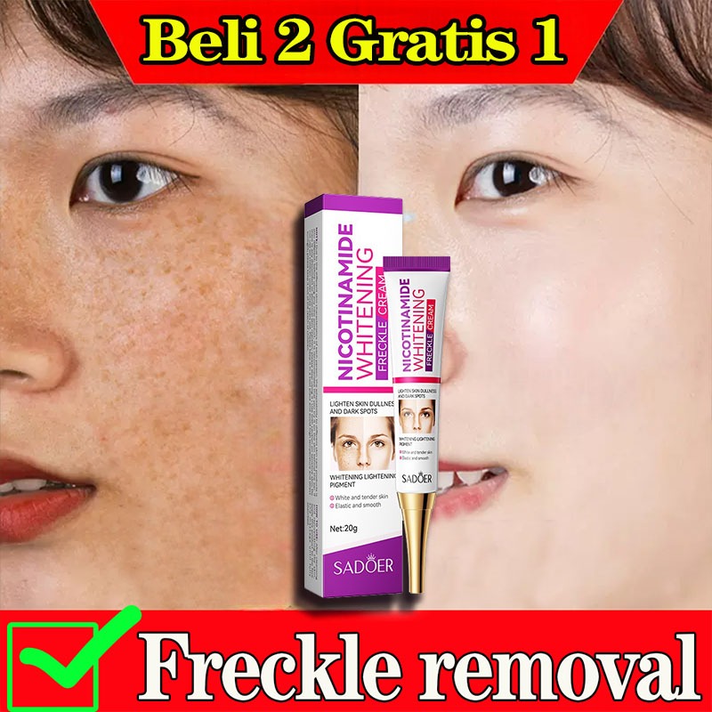 Cream penghilang flek hitam cream flek hitam membandel salep flek hitam membandel menghilangkan flek