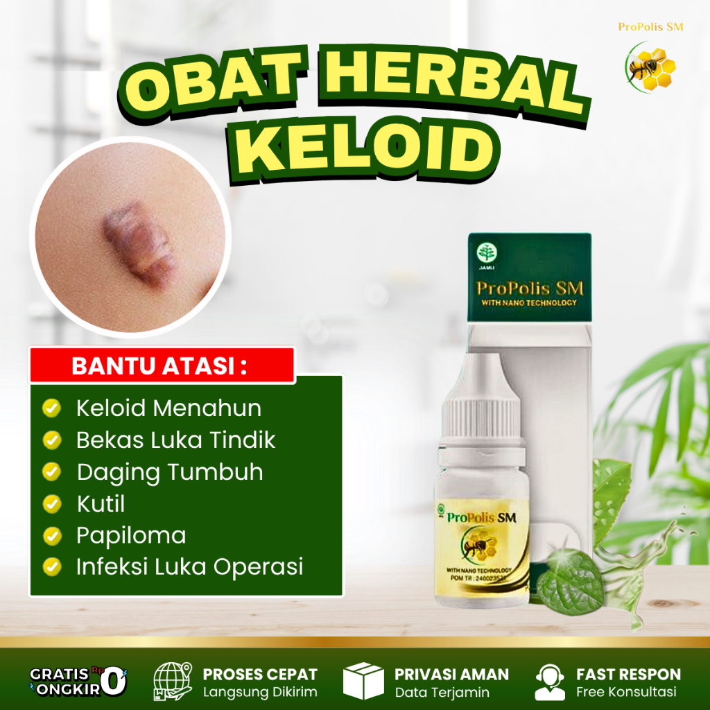 Obat Keloid, Obat Daging Tumbuh, Obat Keloid Injeksi Menahun, Penghilang Keloid Luka Tindik Di Telin