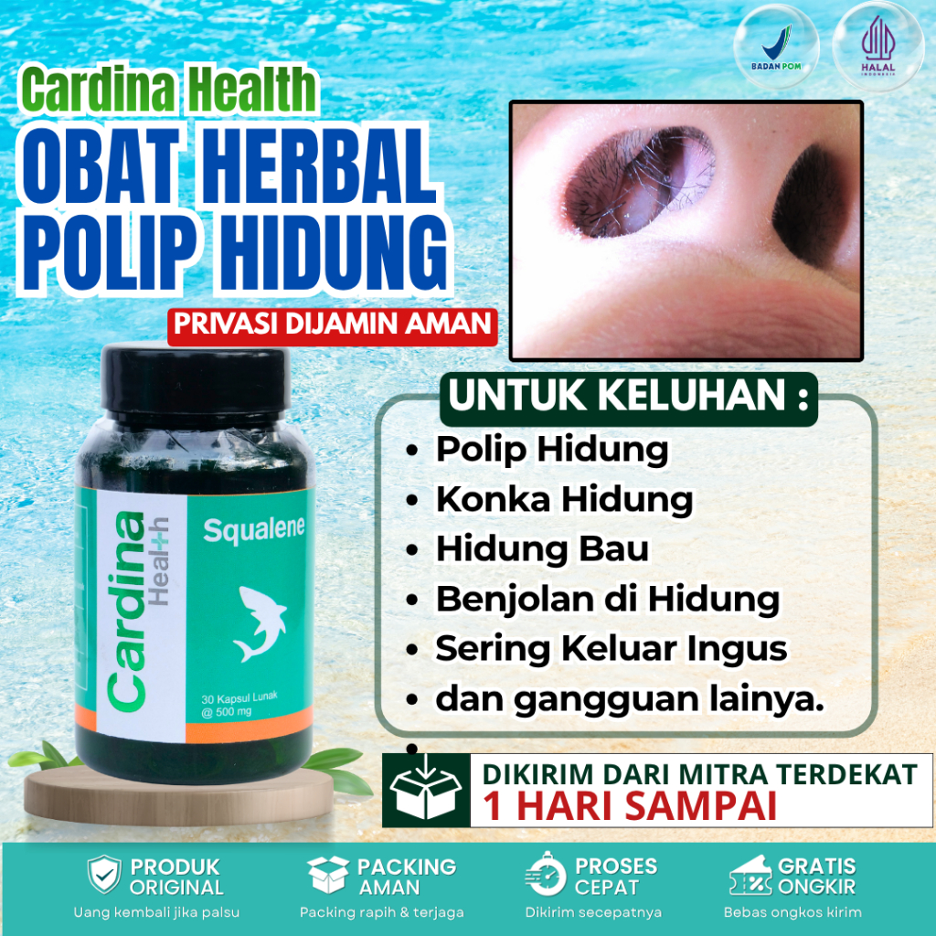 Obat Polip Hidung - Pengempis Polip Hidung Alami Tanpa Efek Samping - Pengobatan Polip Hidung Alami 