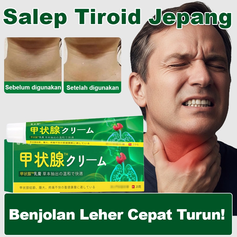 Jepang Salep Tiroid Obat benjolan di leher Obat Gondok 20g Benjolan Dileher Tumor Kelenjar Tiroid Li