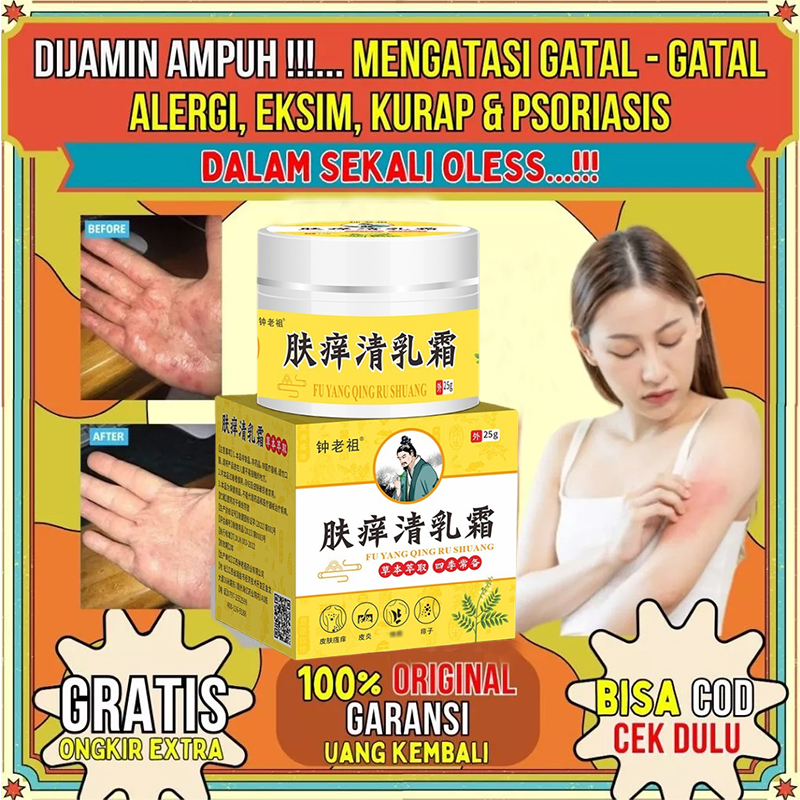 Salep Eksim Kering dan Gatal Salep Gatal China Paling Ampuh Obat Gatal Selangkangan Salep Bayi Untuk