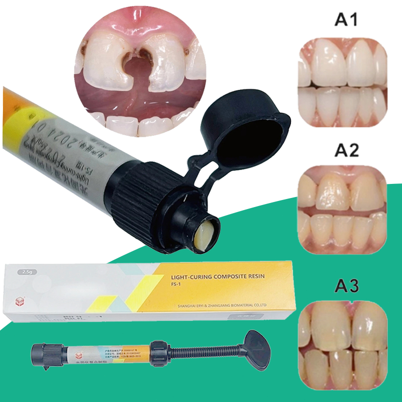 Microhybrid Nanofill Composite Komposit - Bahan Tambal Gigi & Veneer Dental Light Cure Laser untuk T