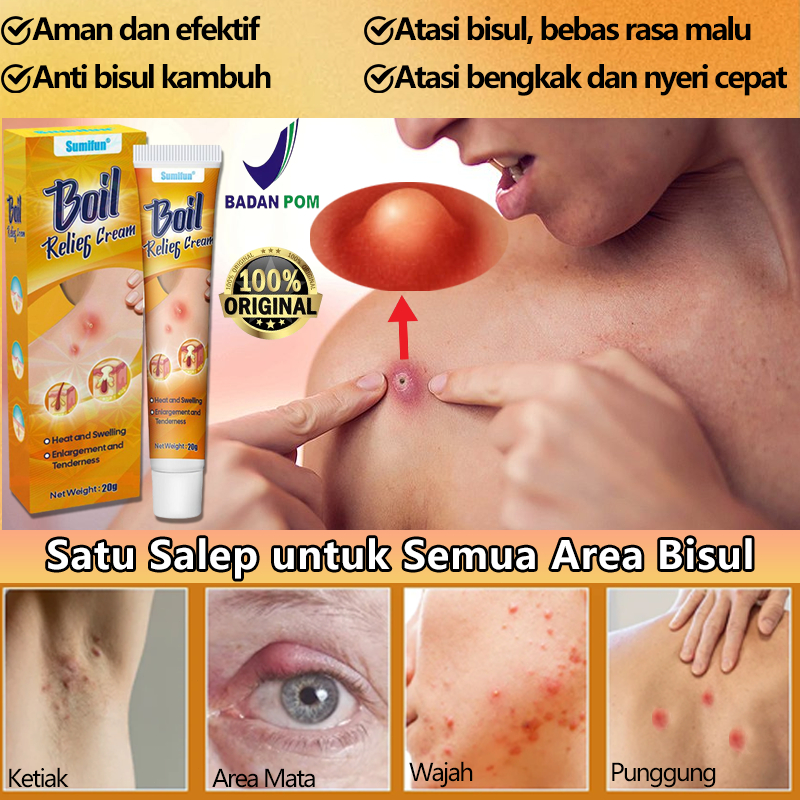Salep bisul paling ampuh Penghilang jerawat batu Salep jamur kulit 20g Salep pengobatan bisul Atasi 