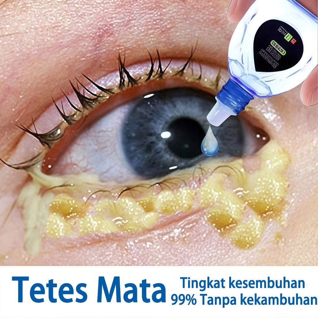 Tetes mata Obat mata Tetes mata minus paling ampuh Yehuangsu tetes mata Obat mata minus Alat tetes m